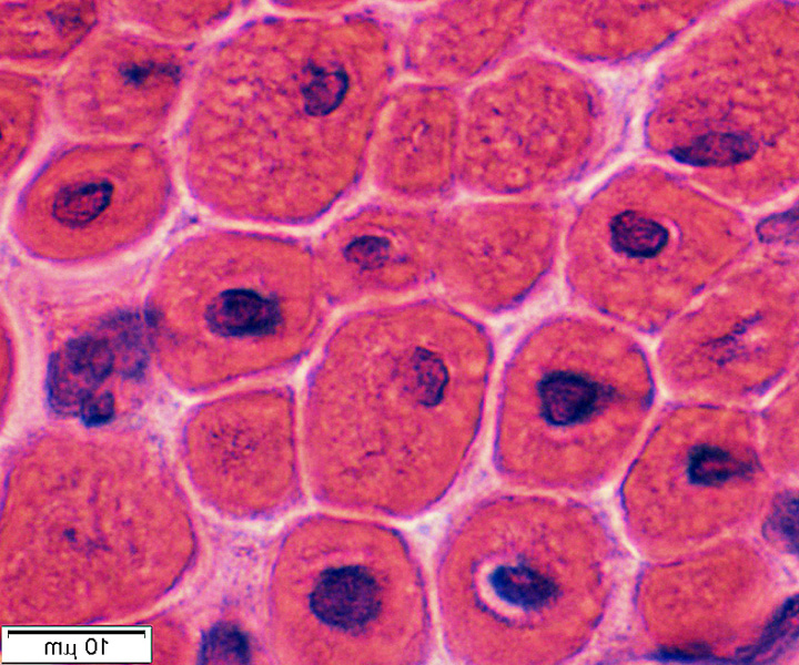 X-Linked-Myotubular-Myopathy GLUT4