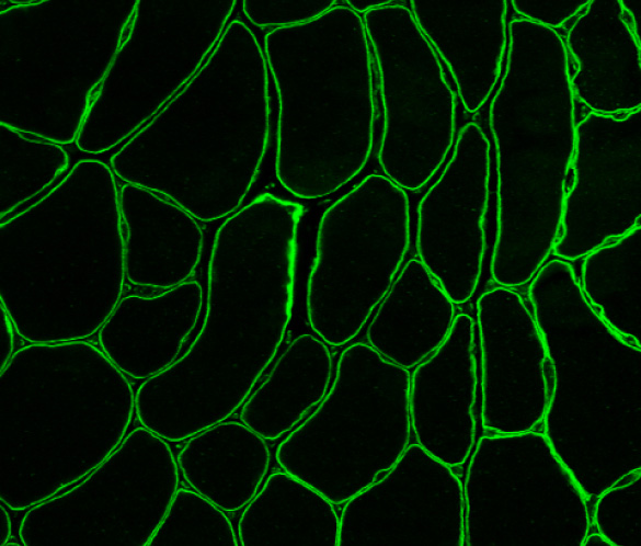 muscle-cs-1 GLUT4 Transporters